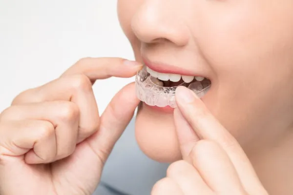 Invisalign Treatment in NIBM