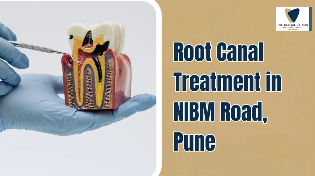 Root Canal Treatment in NIBM Road, Pune