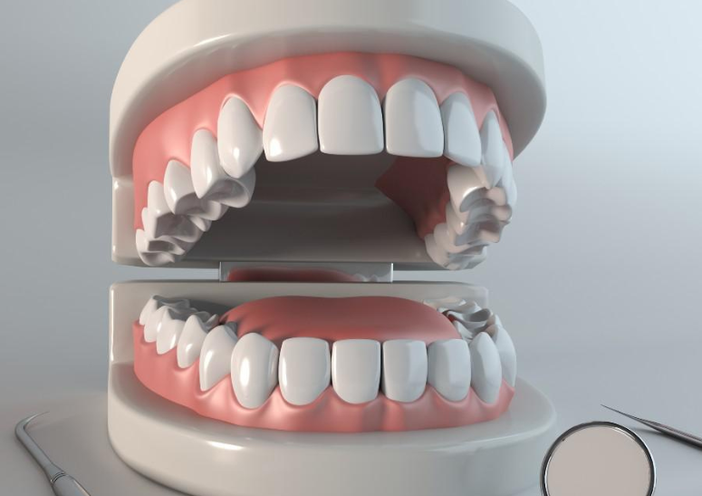 Full Mouth Rehabilitation Pune