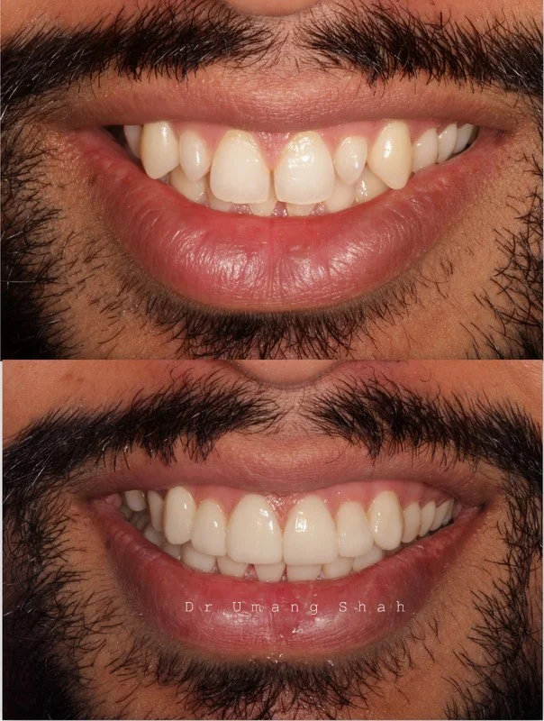 smile 2