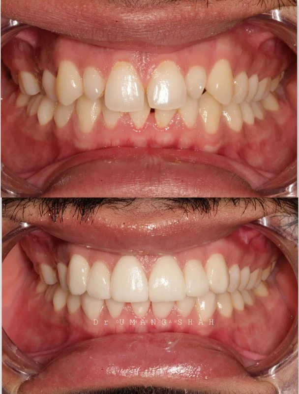 smile 3