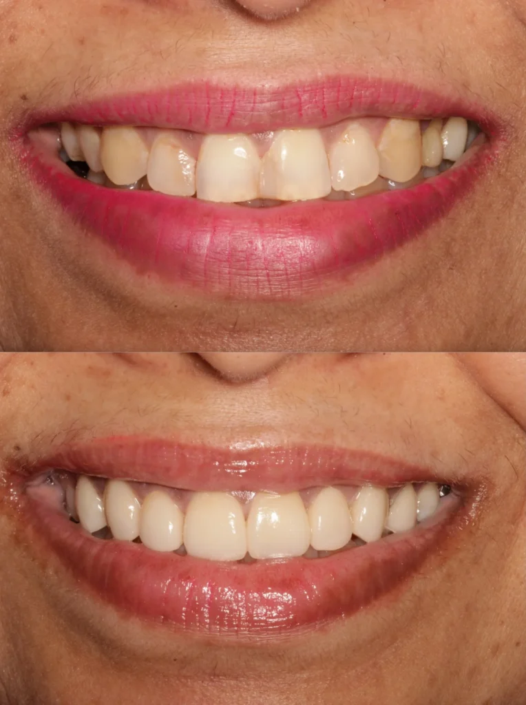 smile 5