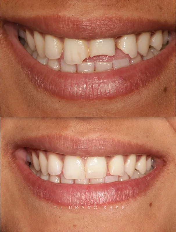 smile 7