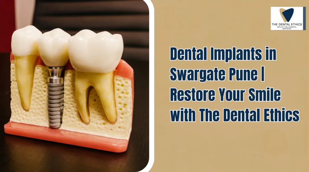 Dental Implants in Swargate Pune Restore Your Smile with The Dental Ethics