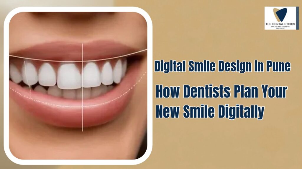 digital-smile-design-pune