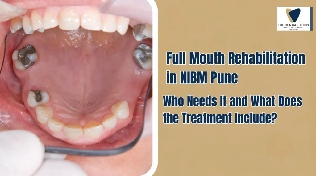 Full Mouth Rehabilitation NIBM Pune